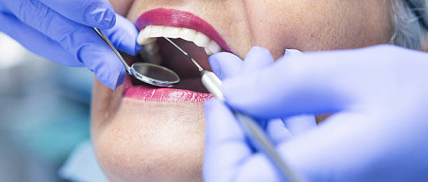 Best Emergency Treatment for Toothache in Glendora, NJ